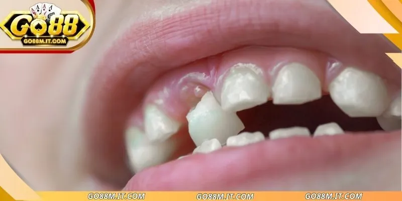 Nằm mơ thấy mất răng nhưng không chảy máu